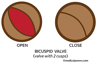 Heart Valve with 2 'cusps' (bicuspid valve)