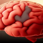 Stroke: focus on the little details of a Brain Attack