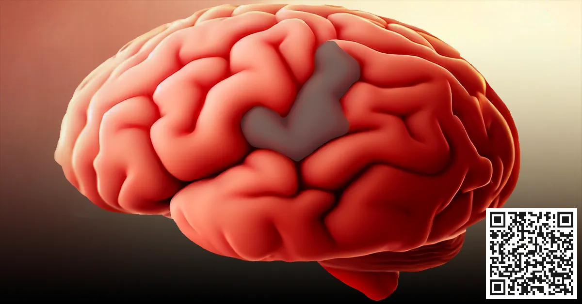 Read more about the article Stroke: focus on the little details of a Brain Attack